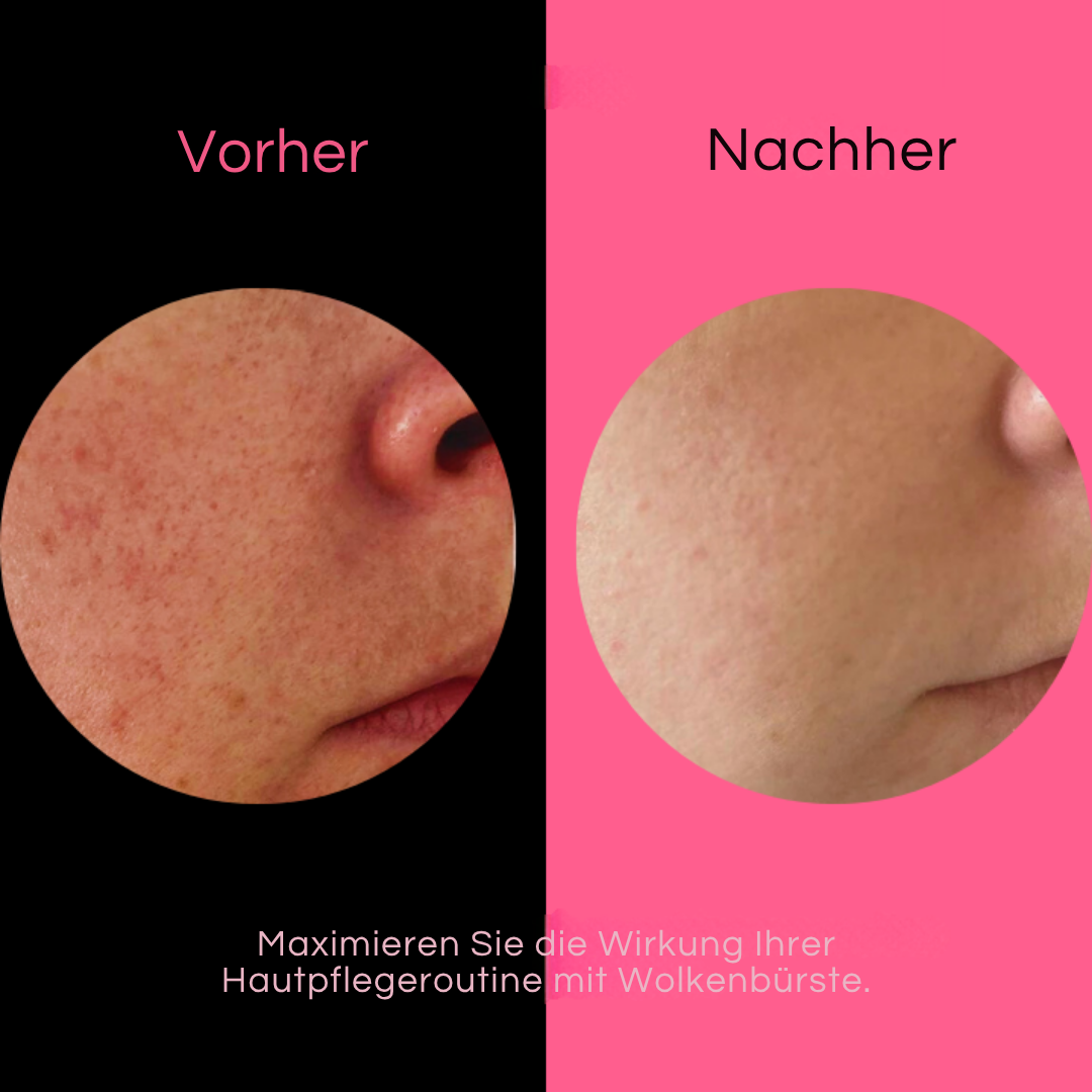 Wolkenbürste™ Esfoliante Ultra-Dolce